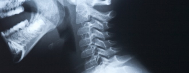 neck-x-ray-2x.jpg